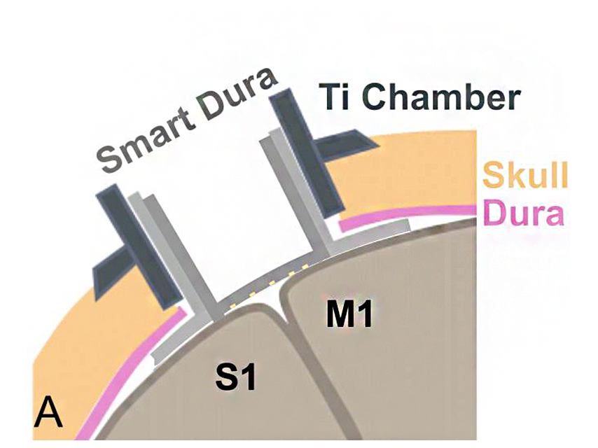 Graphic showing the smart dura, TI chamber, and skull dura