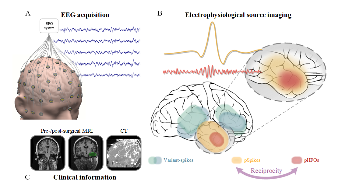 Technical graphic showing EEG acquisition and electrophysical source imaging